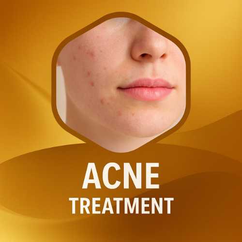 Acne Treatment