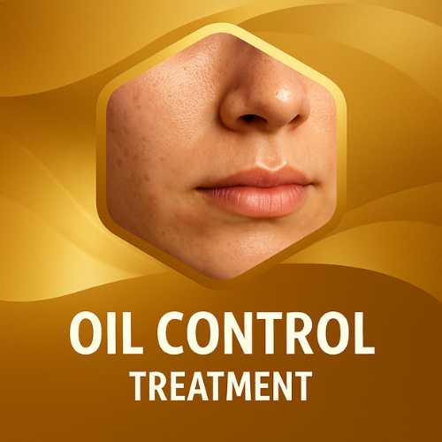 Oil Control Treatment